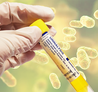 Bacteria in the Urine